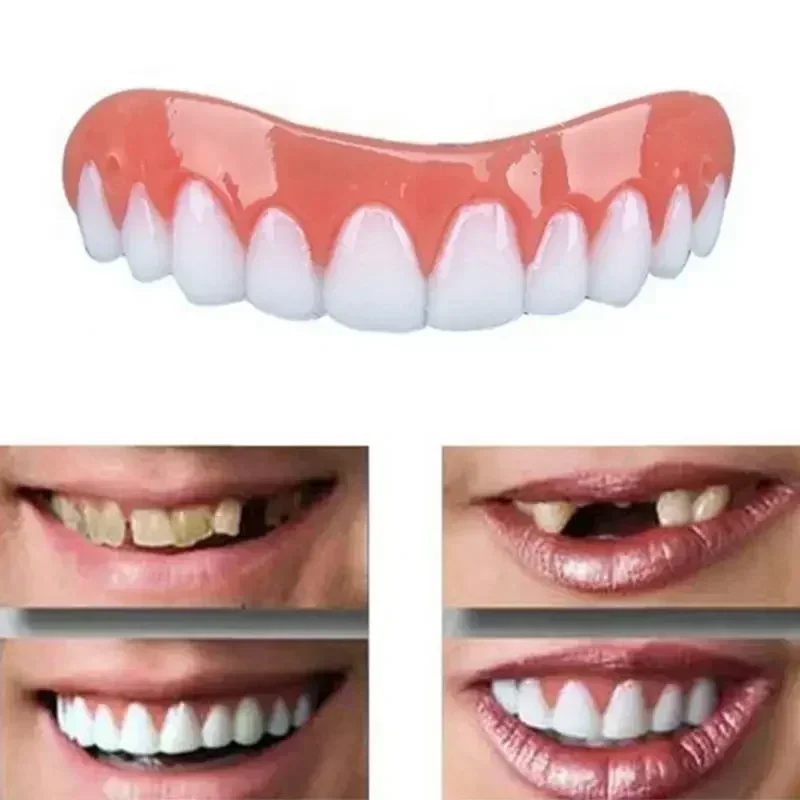 Teeth Whitening Veneers - Nuove Faccette Dentali in Silicone Superiori