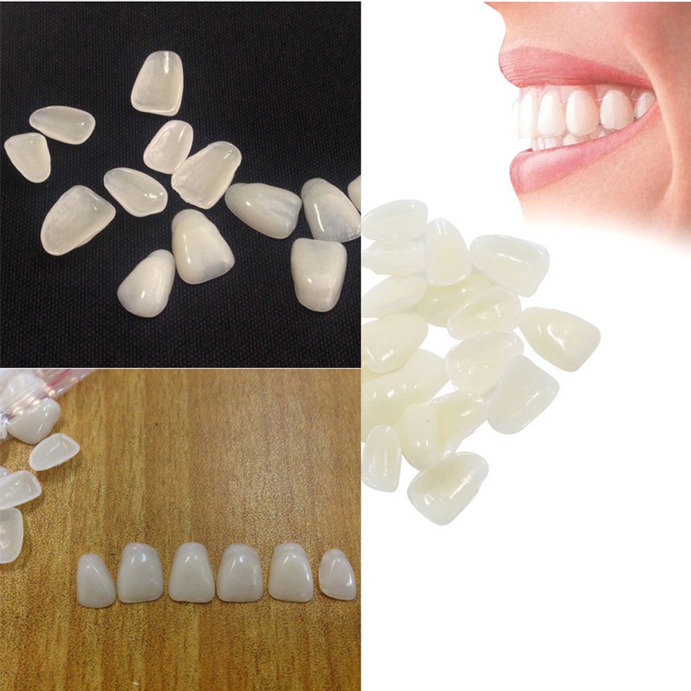 Teeth Whitening Veneers - 70 Pezzi/Confezione Faccette Dentali Estetiche Sbiancanti