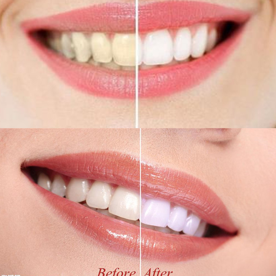 Denti di carbone di bambù dent - Teeth Whitening China recensione e prezzo