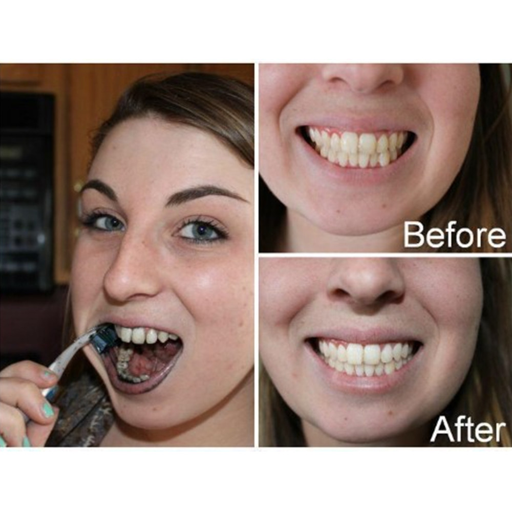 Denti di carbone di bambù dent - Teeth Whitening China recensione e prezzo