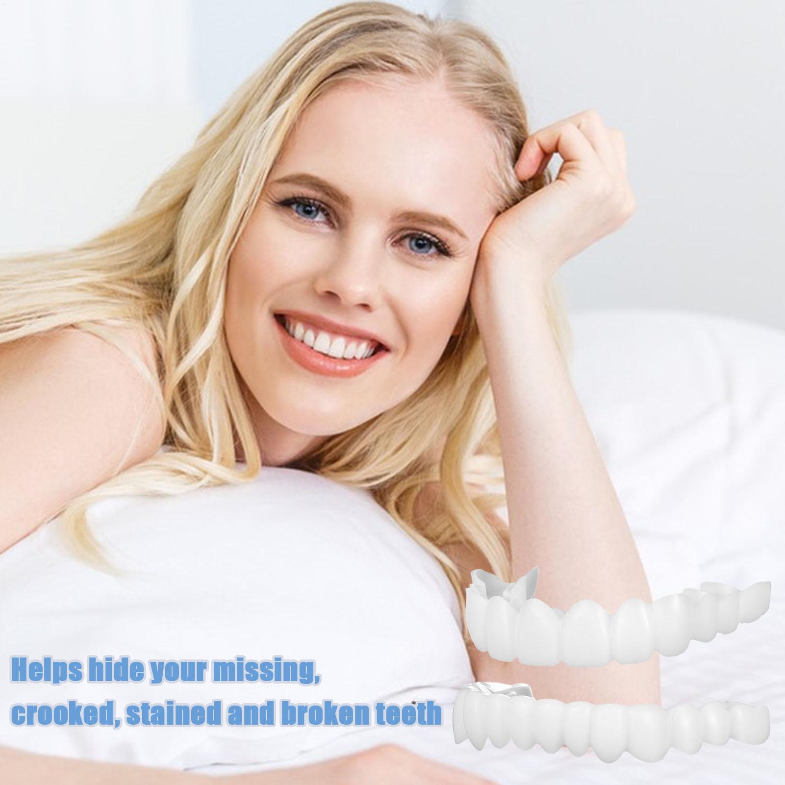 Copertura Dentale Superiore e  - Teeth Whitening Veneers recensione e prezzo
