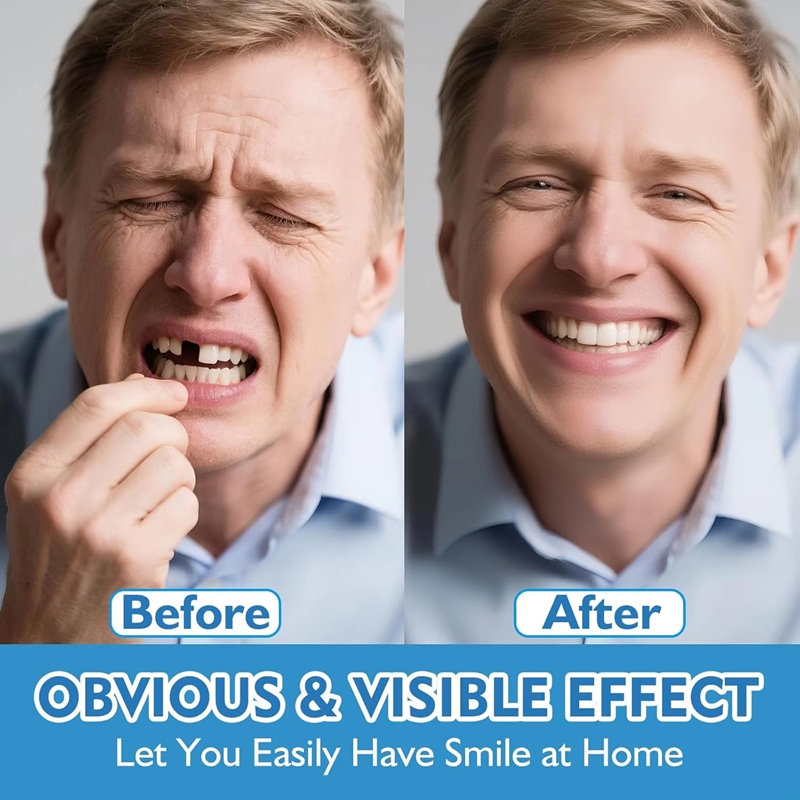 Set Completo di Dentiere in Si - Teeth Whitening Instant recensione e prezzo