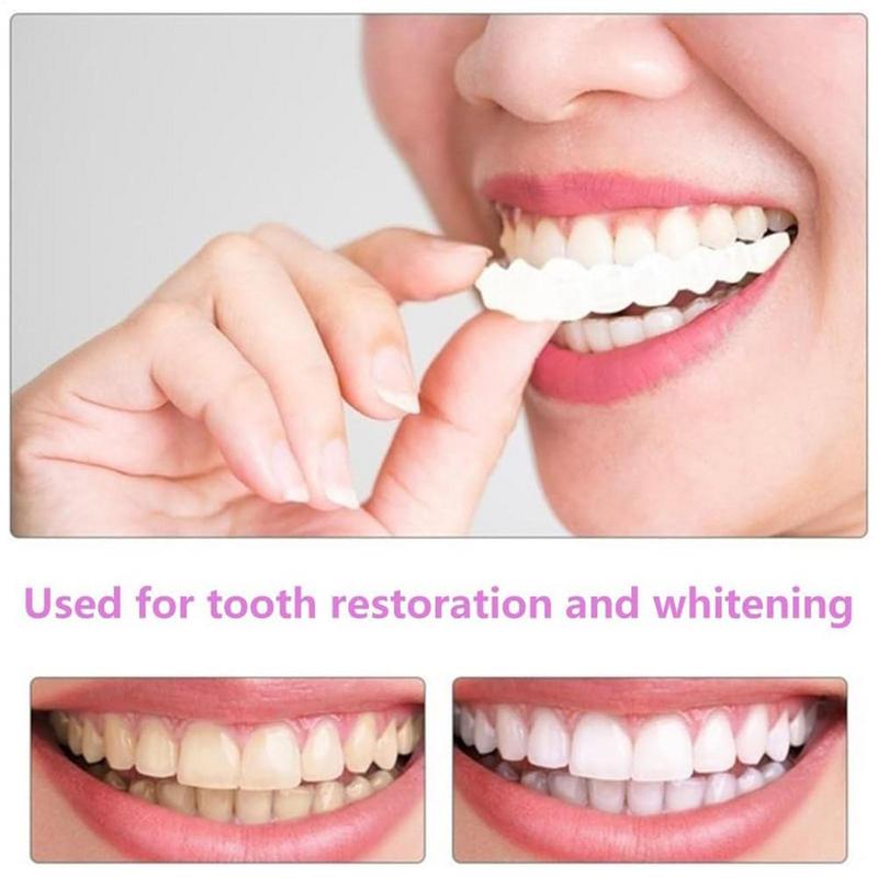 Impiallacciature per denti a s - Teeth Whitening Veneers recensione e prezzo