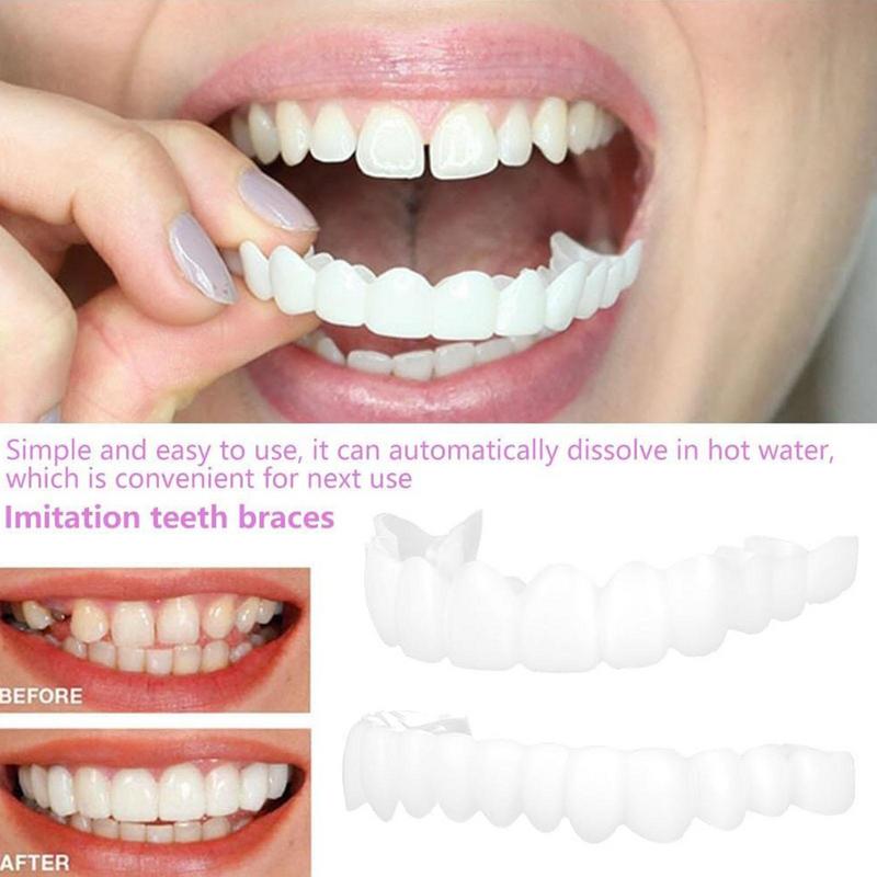 Impiallacciature per denti a s - Teeth Whitening Veneers recensione e prezzo
