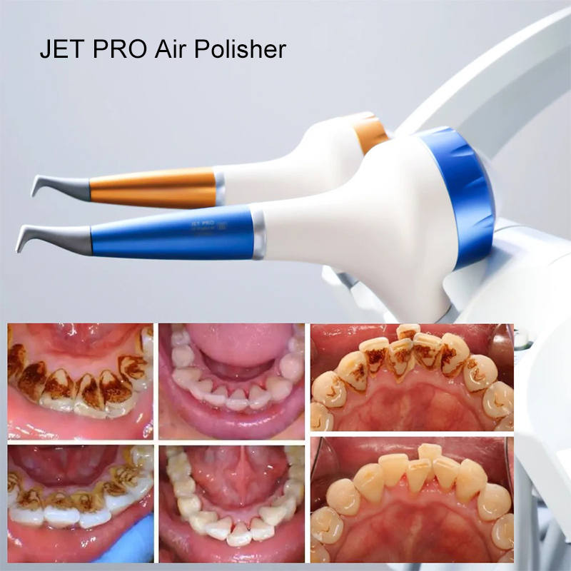 VV Dental Air Polishing Prophy - Teeth Whitening China recensione e prezzo