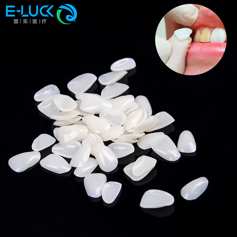 50 pezzi impiallacciature per  - Teeth Whitening Veneers recensione e prezzo